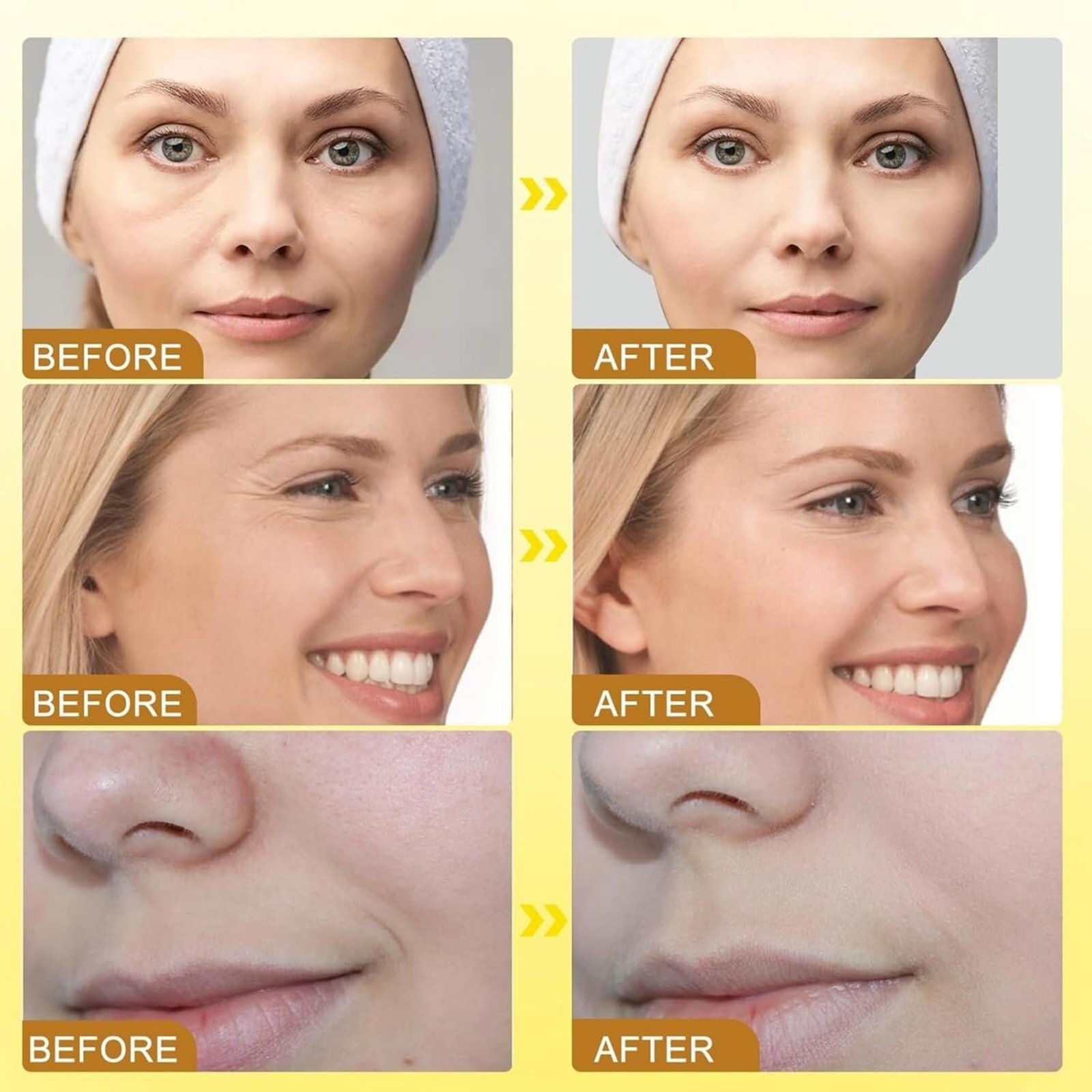 Botox Bee Venom Wrinkle Cream in Pakistan | Anti-Aging & Collagen Boosting Moisturizer - Image 5