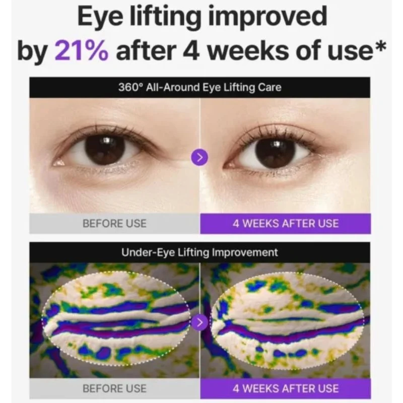 Centellian24 360° Shot PDRN Lifting Eye Cream | Anti-Aging Eye Cream for Wrinkles, Puffiness & Dark Circles | Firming & Hydrating Formula | 30ml - Image 7